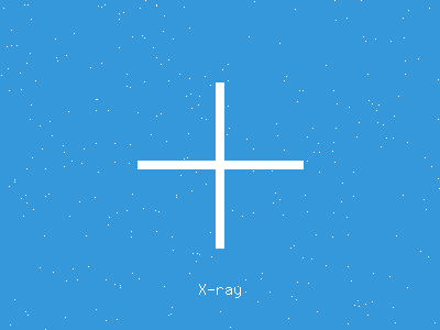 X-ray